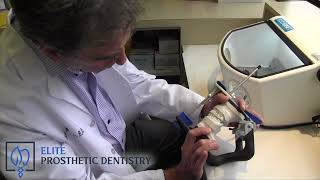 What Factors Can Determine the Long Term Success of Dental Implant Therapy?