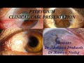 PTERYGIUM Clinical case presentation