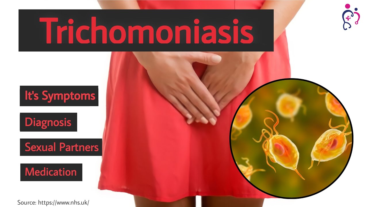 Trichomoniasis trichomoniasis cure? trichomoniasis test