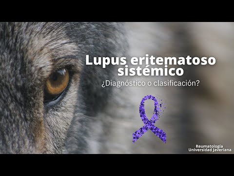 Diagnóstico de lupus