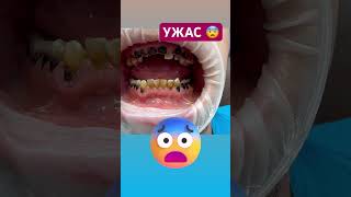 😭п….ц товарищи? Что за ужас? 😨 #шортс #зубы #медицина