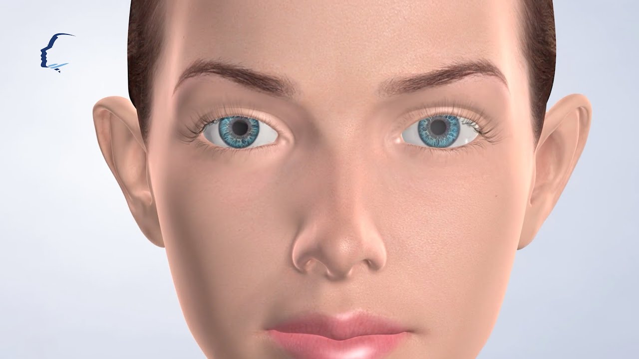 Ear Surgery at Carolinas Center for Cosmetic Surgery YouTube