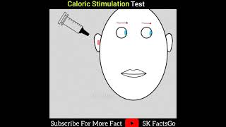What Is Caloric Stimulation Test #shorts #indiashorts #sk_factsgo #facts