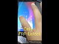 Redmi 5A Frp By UMT Dongle Unlock solution