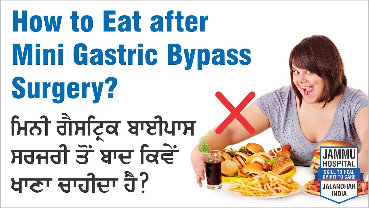 How to eat after Mini Gastric Bypass Surgery? [ Dr GS Jammu, Bariatric