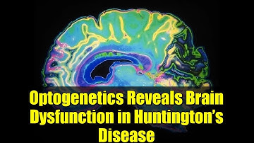 Optogenetics Reveals Brain Dysfunction in Huntington’s Disease