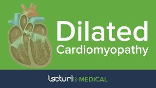 Dilated Cardiomyopathy | Cardiology