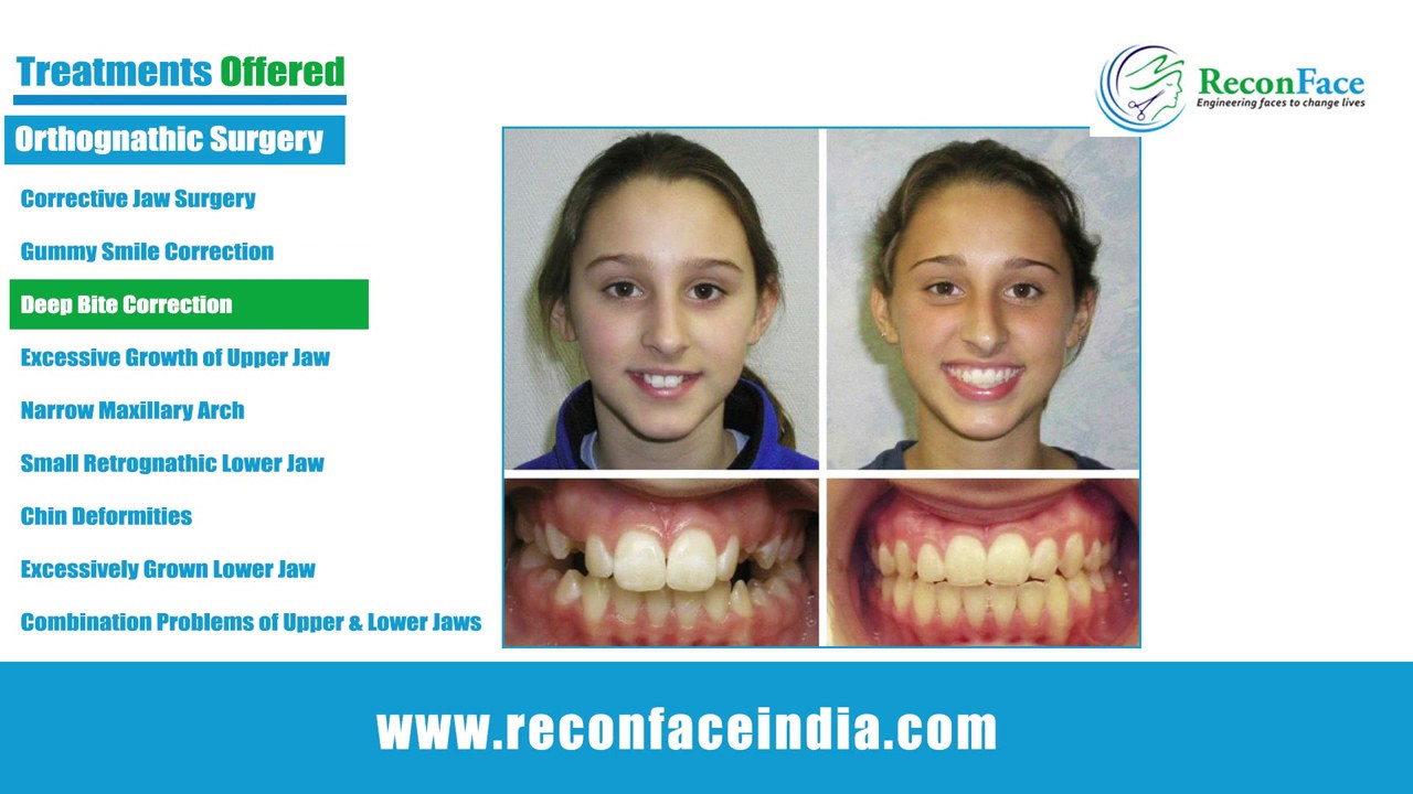 Cosmetic Surgery in Hyderabad Facial Deformity Correction Cosmetic