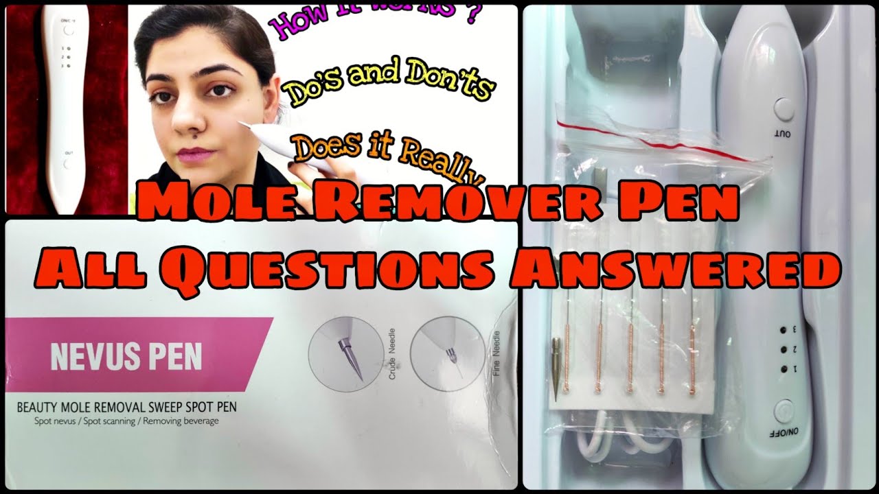 Mole Remover Pen k lie itne saray comments .. Sab ka answer is video ...