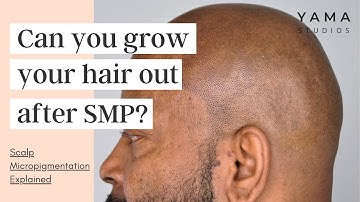 Can You Grow Your Hair Out After Scalp Micropigmentation? SMP Explained