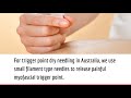Dry Needling Therapy for Chronic Body Pain and Trigger Point Dysfunction