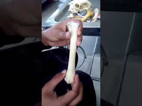 Introduction of Radius bone - YouTube