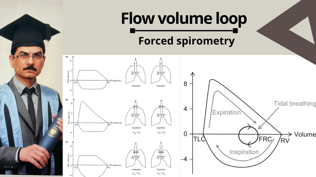 Flow volume loop | Zulfiqar memon