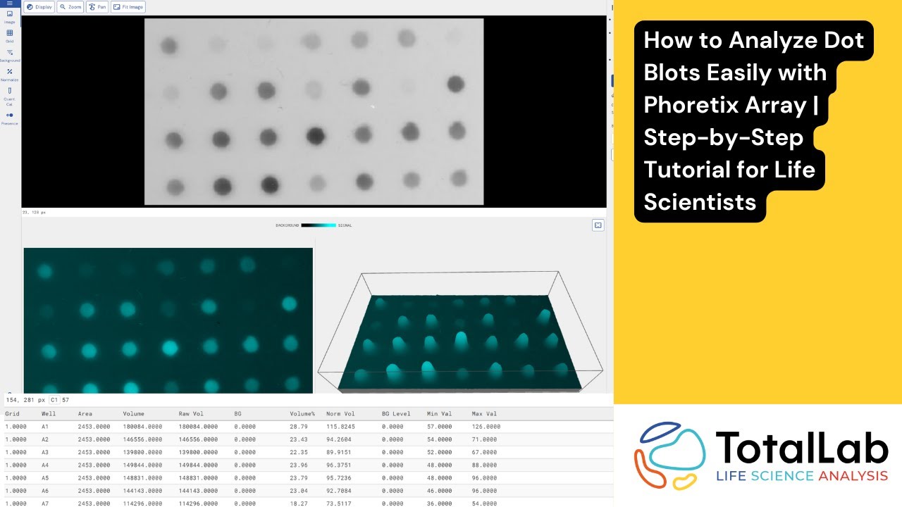 Dot Blot Analysis Tutorial: Complete Guide to Phoretix Array Software for Researchers