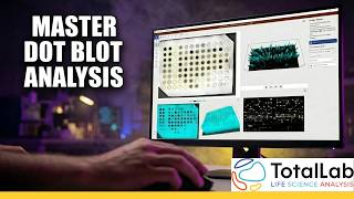 Automated Dot Blot Analysis & Quantification Tutorial | Phoretix Array