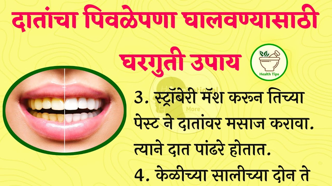दातांचा पिवळेपणा घालवण्यासाठी घरगुती उपाय Teeth whitening