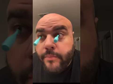 MY EYEBALL CAME OUT G3225