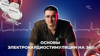 Основы электрокардиостимуляции на ЭКГ