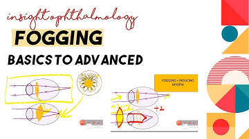 WHAT IS FOGGING TEST || WHY , WHEN AND HOW TO FOG || OPTICS AND REFRACTION SERIES||