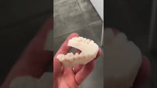 Very High-Quality Dental 3D Printing!