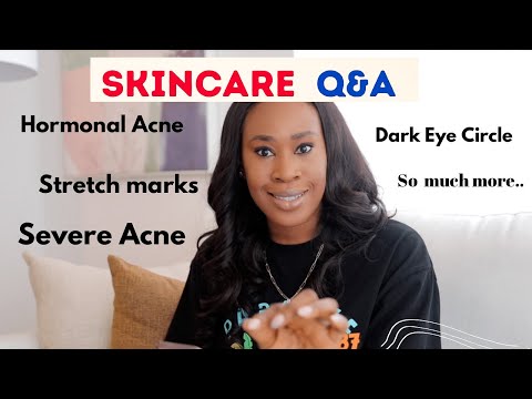 Video Dark Eye Circle, Severe Acne , Stretch Marks. - youtube