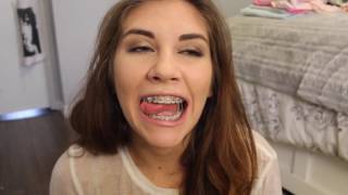 Braces & Rubberbands Video of Bracefacebeauty Victoria