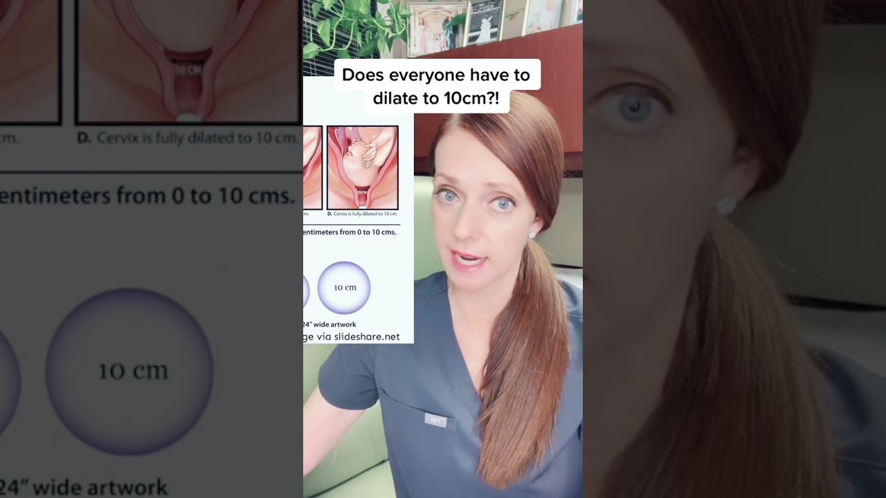 Not Everyone Has To Dilate Exactly 10cm Be Fully Dilated 