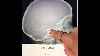 Skull Image Evaluations