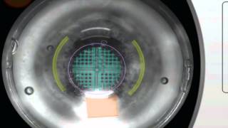 Catalys Precision Laser System