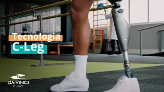 Tecnologia C-Leg