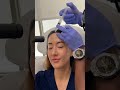Exosome Therapy Explained | Regenerative Aesthetics at Enfield Royal Viera