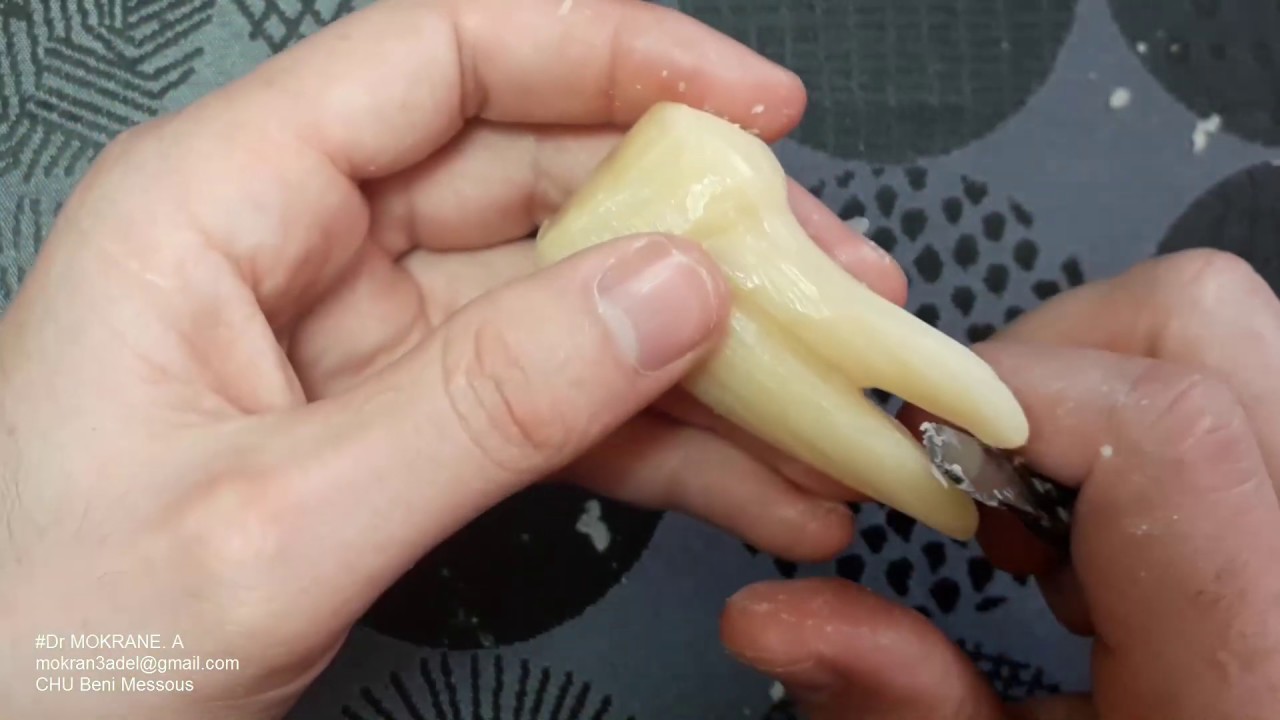 Démonstration en temps réel: Sculpture de la Première PM Sup G (Partie 02: Finitions des Racines)