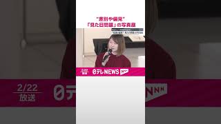 【差別や偏見】「見た目問題」の写真展  病気などで特徴的な症状で  #shorts