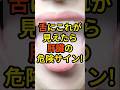 舌にこれが見えたら肝臓の危険サイン! #肝臓 #舌の異常 #肝臓病 #黄疸 #肝硬変 #肝炎 #脂肪肝 #早期発見 #予防医学 #ビリルビン #紅舌 #鏡面舌 #肝機能 #沈黙の臓器
