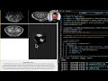 Fixing Volumetric Data &amp; Lighting in 3D Brain Model: Enhancing Visuals and Mouse Control