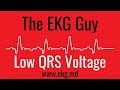 Low QRS Voltage on EKG / ECG l The EKG Guy - www.ekg.md