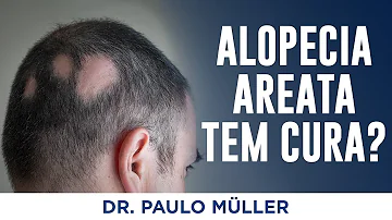 Quanto dura un alopecia areata?