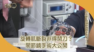 旋轉肌斷裂非得開刀關節鏡手術大公開【聚焦2.0】第431集