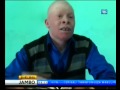 Chama cha Walemavu wa ngozi Albino Mkoani Mbeya kimeiagiza serikali kufuta vibali vya Waganga wanaopiga ramli ili kukomesha mauaji ya albino.