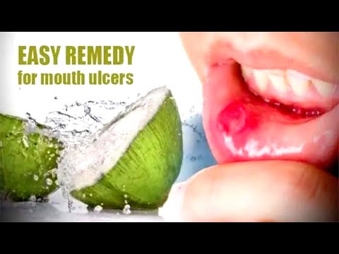 Drink coconut water to deal with mouth ulcers!!