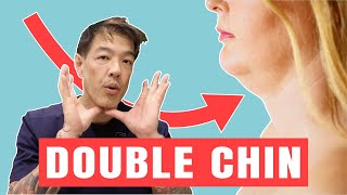 How to Get Rid of a Double Chin | Dr Davin Lim Net Worth