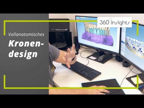 Vollanatomisches Kronendesign | 360°zahn insights