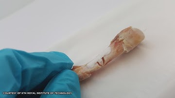 Can Broken Bones Be Healed with Glue?