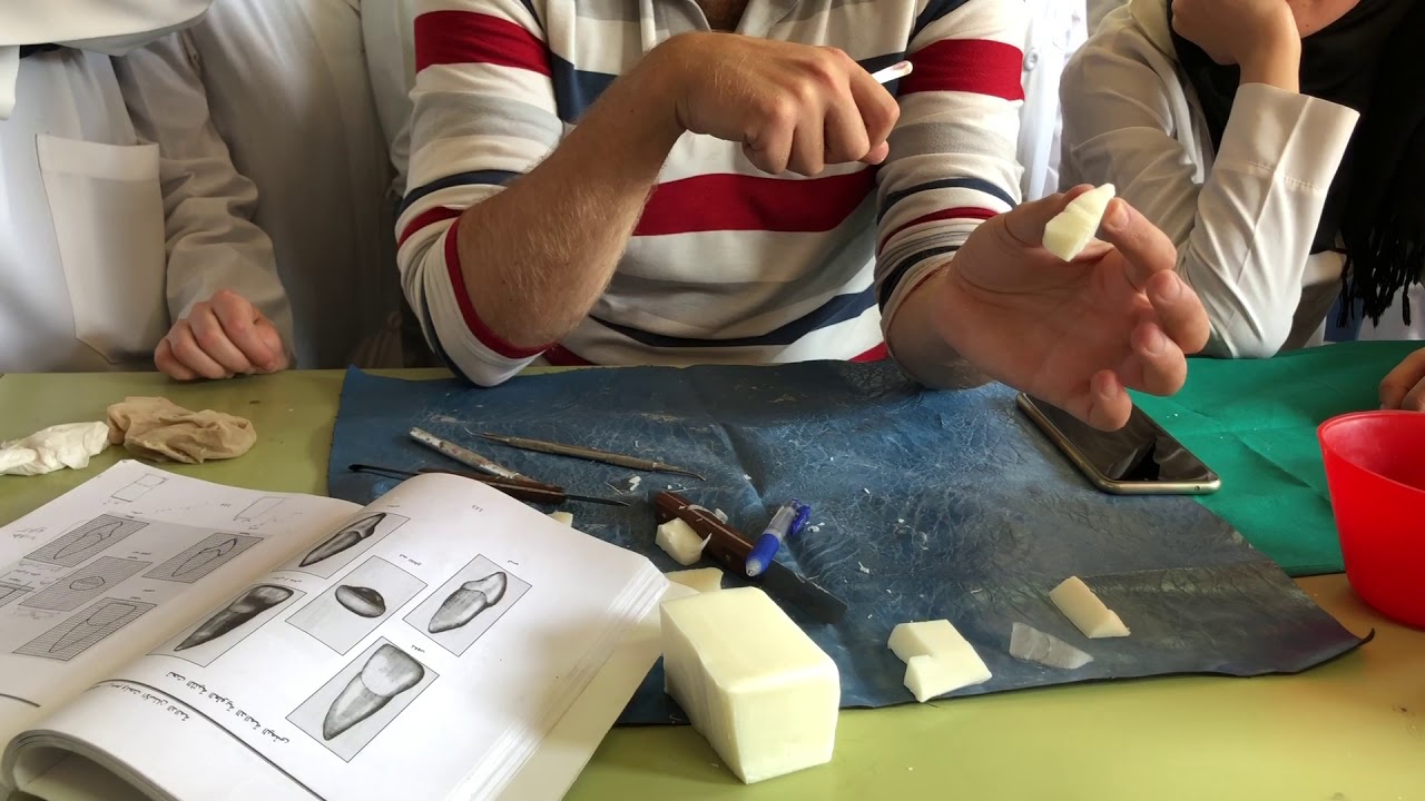 نحت ثنية علوية الدائمة-تشريح الاسنان