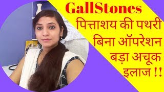 Gallstones symptoms & homeopathic treatment | gallbladder stones symptoms & homeopathic medicine screenshot 5