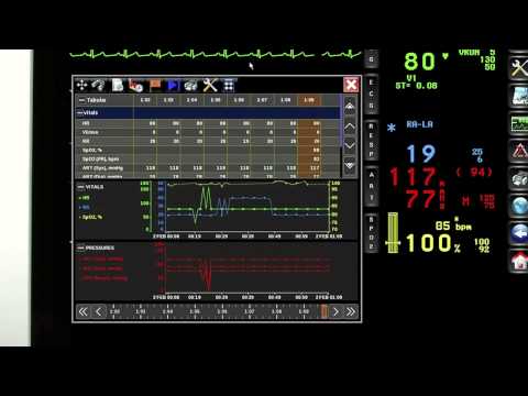 XPREZZON patient monitoring and connectivity I Spacelabs Healthcare