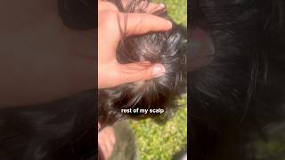 Hairloss serum update