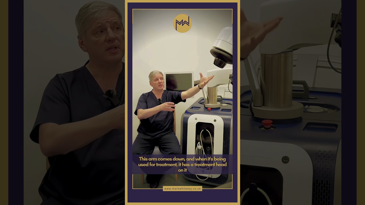 Echotherapy Vs Endovenous Lase or Radiofrequency for Varicose Vein Treatement By Prof. Mark Whiteley