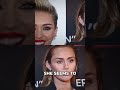 Miley Cyrus's Veneer Mishap & Buccal Fat Removal