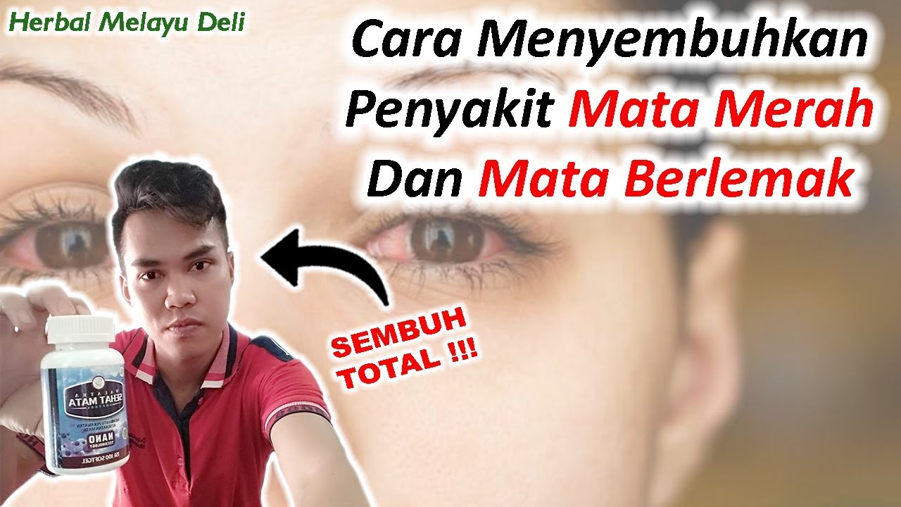 Cara Menyembuhkan Penyakit Mata Merah dan Mata Berlemak – Testimoni